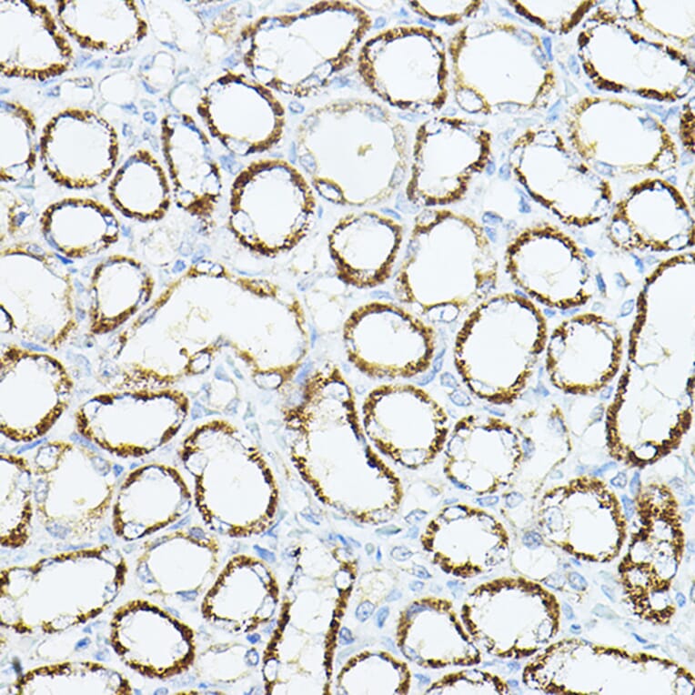 Immunohistochemistry - Anti-VEGFB Antibody (A88829) - Antibodies.com