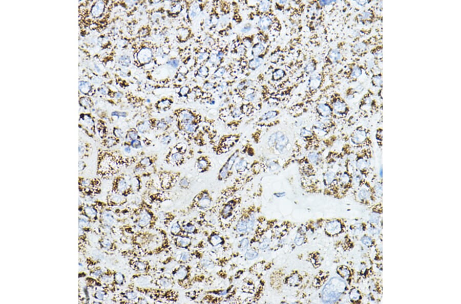 Immunohistochemistry - Anti-VEGFB Antibody (A88829) - Antibodies.com