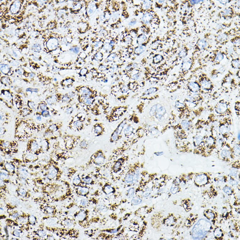 Immunohistochemistry - Anti-VEGFB Antibody (A88829) - Antibodies.com