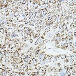 Immunohistochemistry - Anti-VEGFB Antibody (A88829) - Antibodies.com