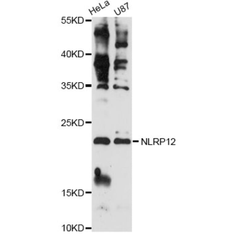 Western Blot - Anti-CSH1 Antibody (A14528) - Antibodies.com