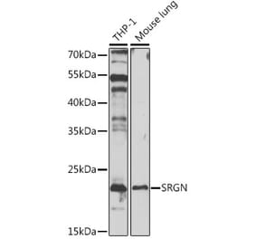 Western Blot - Anti-Serglycin Antibody (A88831) - Antibodies.com