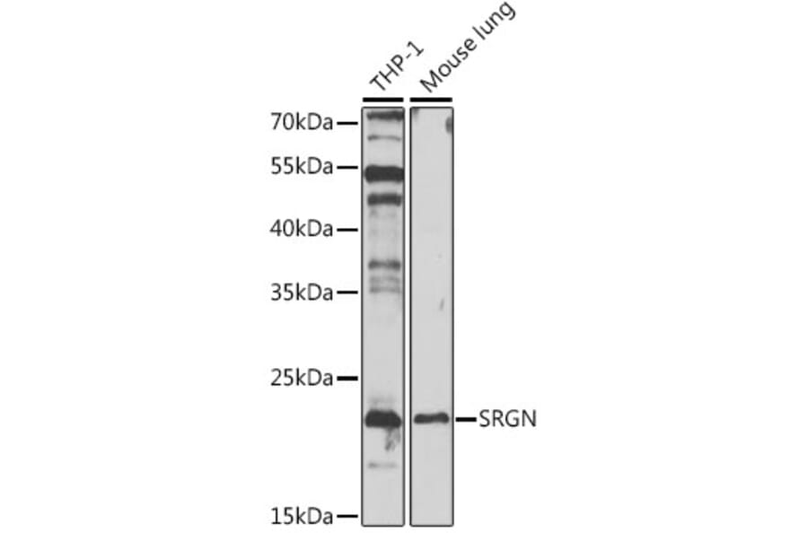 Western Blot - Anti-Serglycin Antibody (A88831) - Antibodies.com