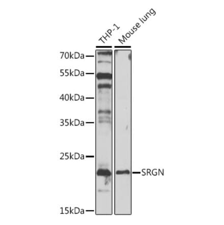 Western Blot - Anti-Serglycin Antibody (A88831) - Antibodies.com