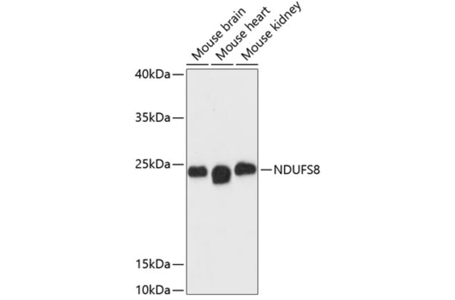 Western Blot - Anti-NDUFS8 Antibody (A88832) - Antibodies.com