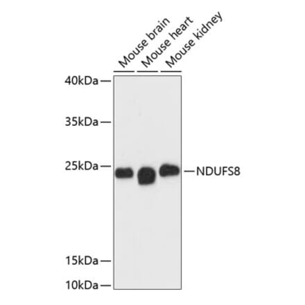 Western Blot - Anti-NDUFS8 Antibody (A88832) - Antibodies.com