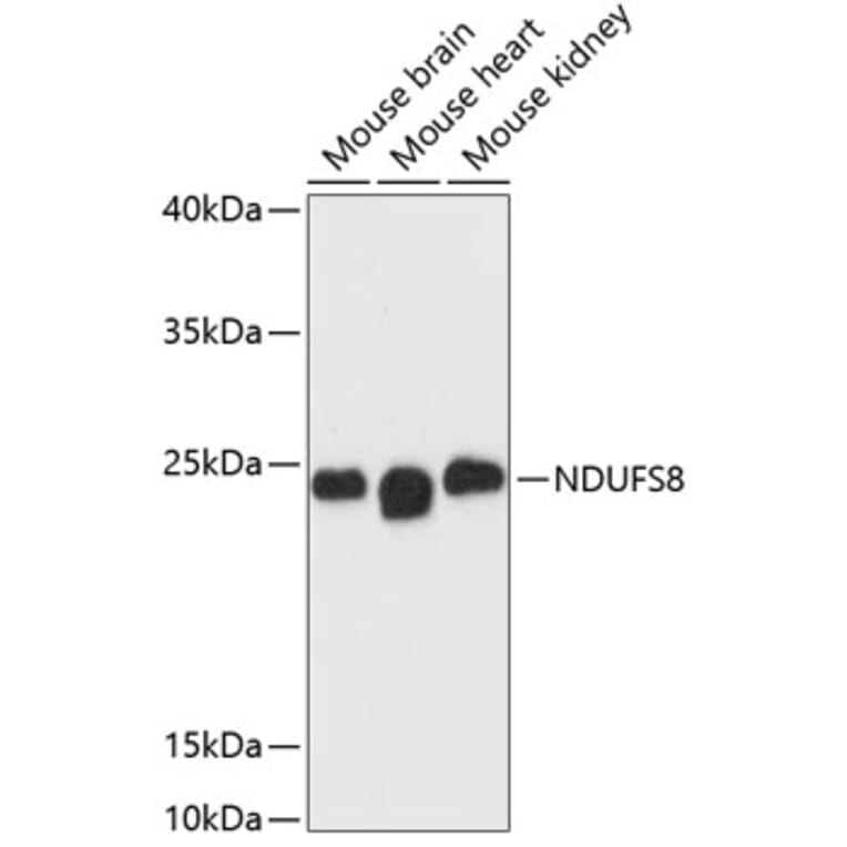 Western Blot - Anti-NDUFS8 Antibody (A88832) - Antibodies.com