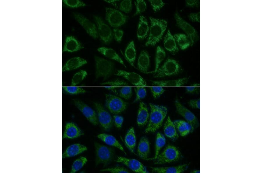 Immunofluorescence - Anti-NDUFS8 Antibody (A88832) - Antibodies.com