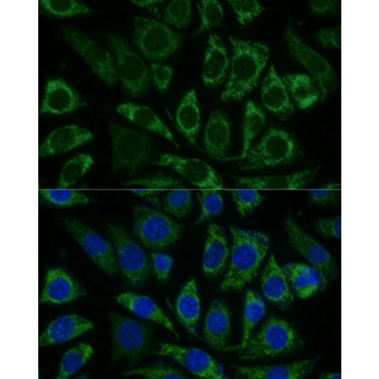 Immunofluorescence - Anti-NDUFS8 Antibody (A88832) - Antibodies.com