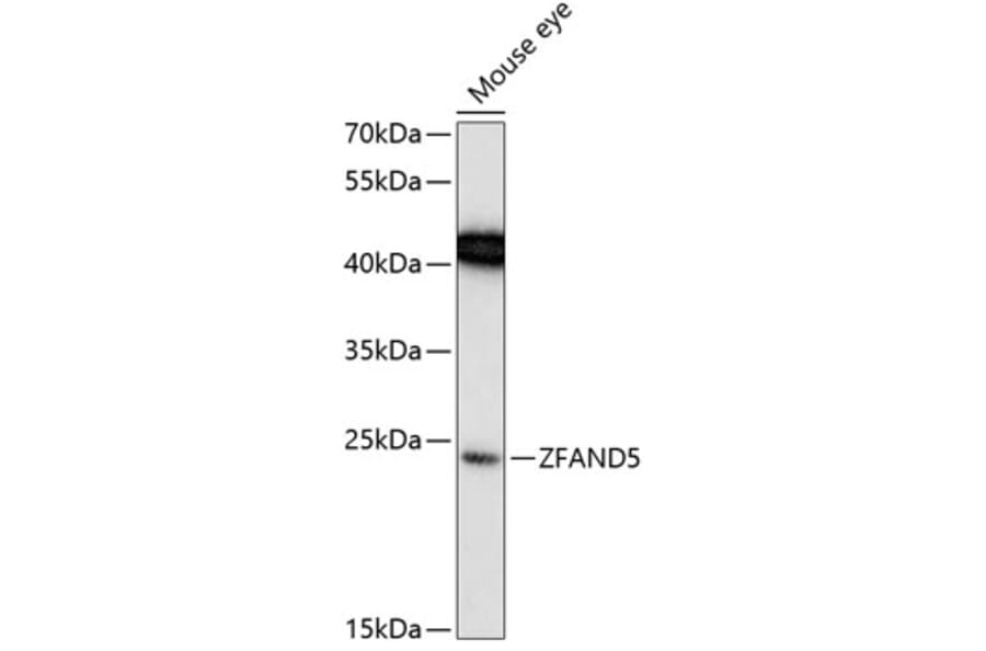 Western Blot - Anti-ZFAND5 Antibody (A88833) - Antibodies.com
