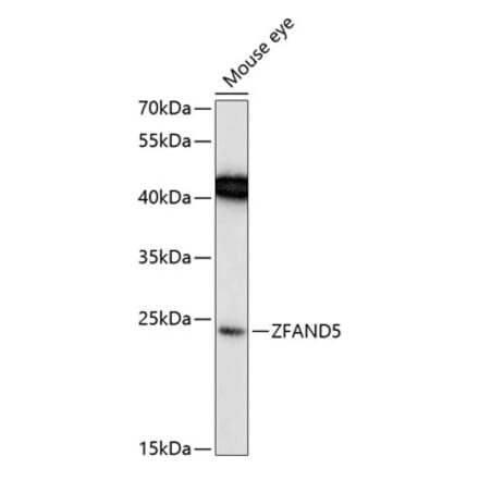 Western Blot - Anti-ZFAND5 Antibody (A88833) - Antibodies.com