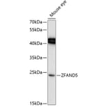 Western Blot - Anti-ZFAND5 Antibody (A88833) - Antibodies.com