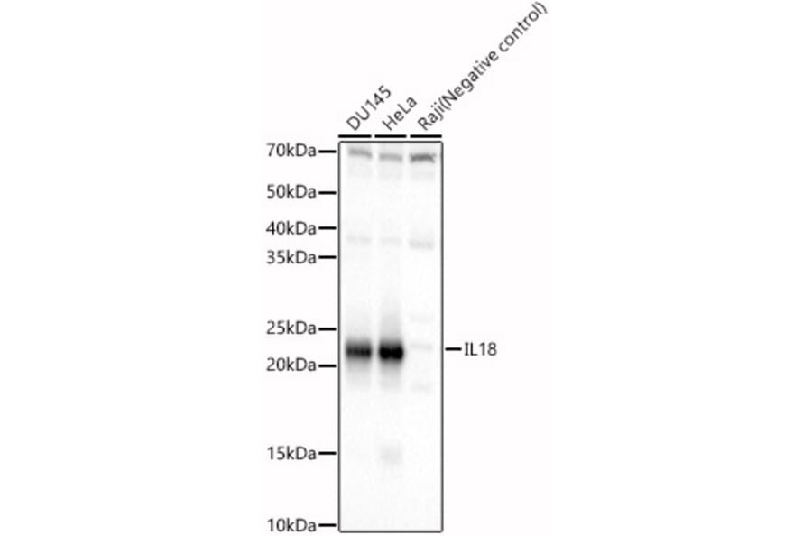 Western Blot - Anti-IL-18 Antibody (A88834) - Antibodies.com