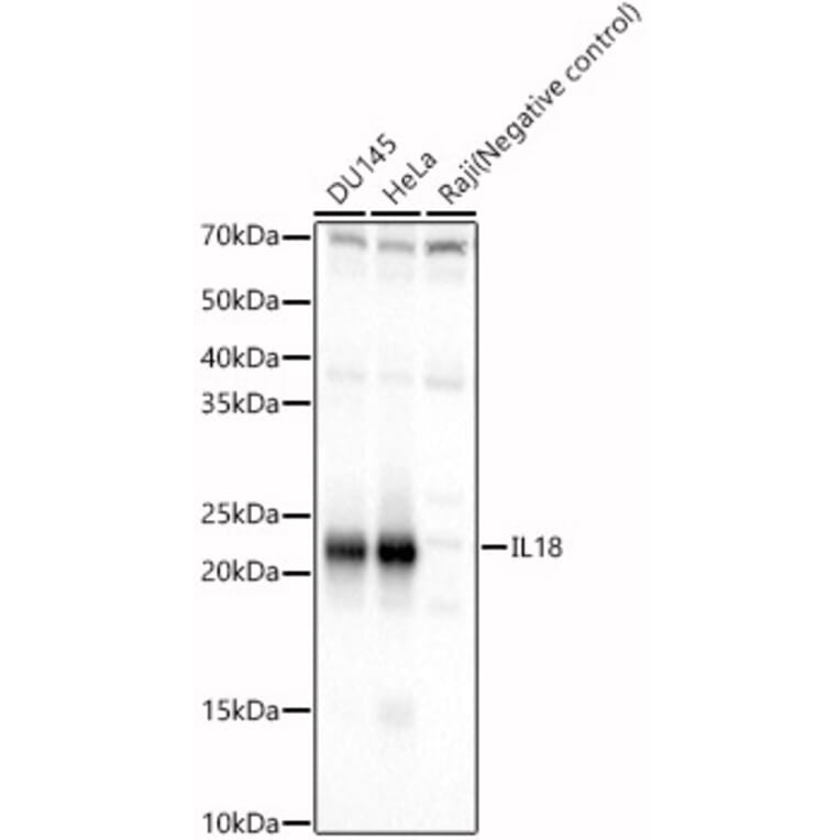 Western Blot - Anti-IL-18 Antibody (A88834) - Antibodies.com