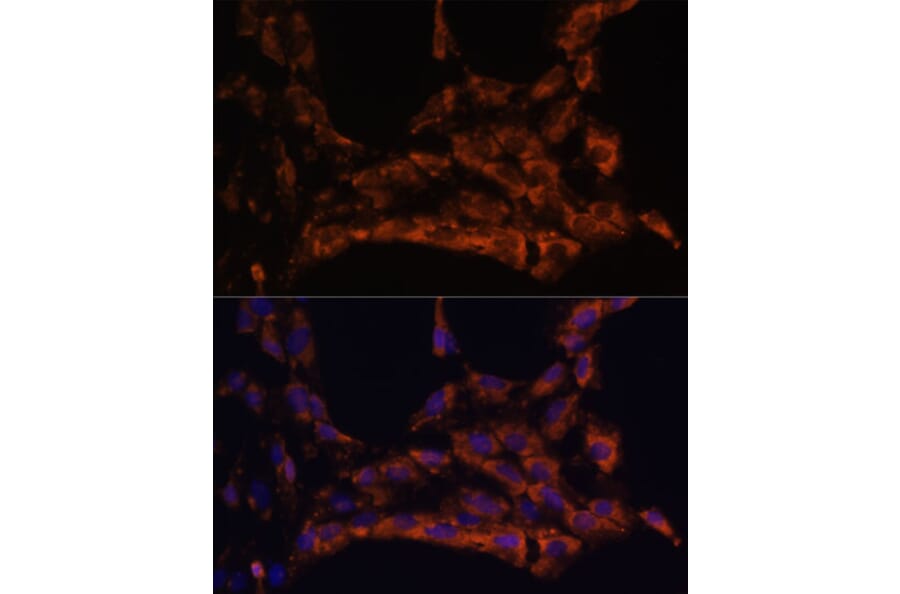 Immunofluorescence - Anti-IL-18 Antibody (A88834) - Antibodies.com