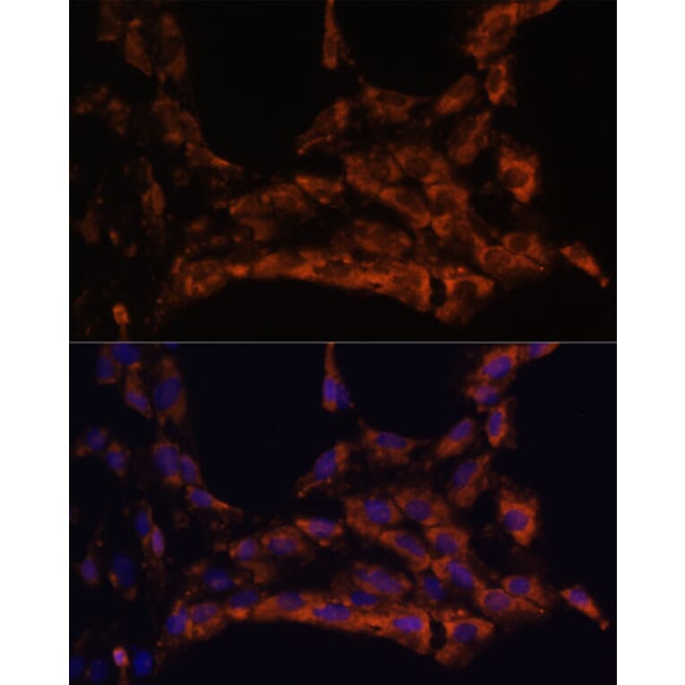 Immunofluorescence - Anti-IL-18 Antibody (A88834) - Antibodies.com