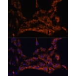 Immunofluorescence - Anti-IL-18 Antibody (A88834) - Antibodies.com