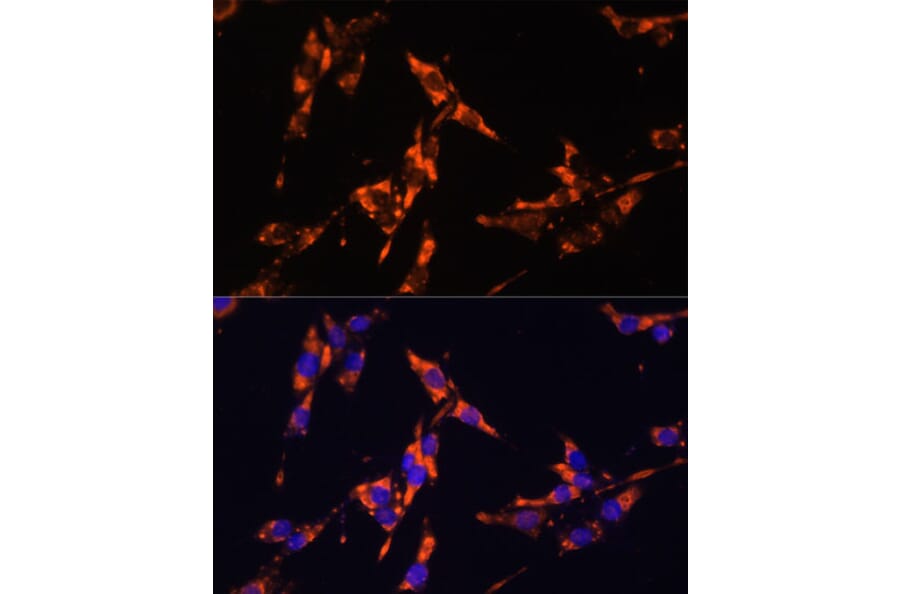 Immunofluorescence - Anti-IL-18 Antibody (A88834) - Antibodies.com