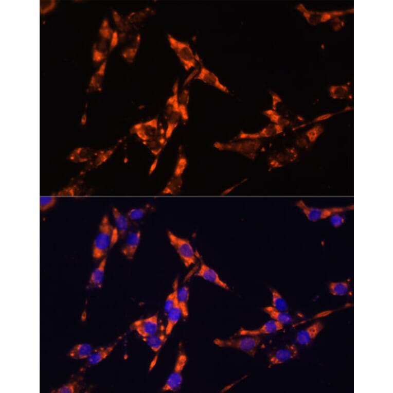 Immunofluorescence - Anti-IL-18 Antibody (A88834) - Antibodies.com