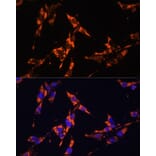 Immunofluorescence - Anti-IL-18 Antibody (A88834) - Antibodies.com