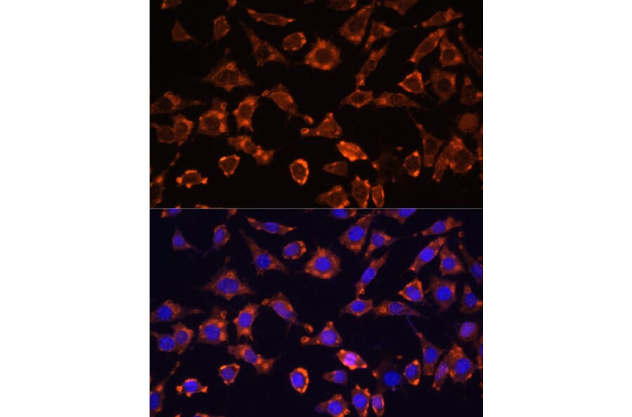 Immunofluorescence - Anti-IL-18 Antibody (A88834) - Antibodies.com