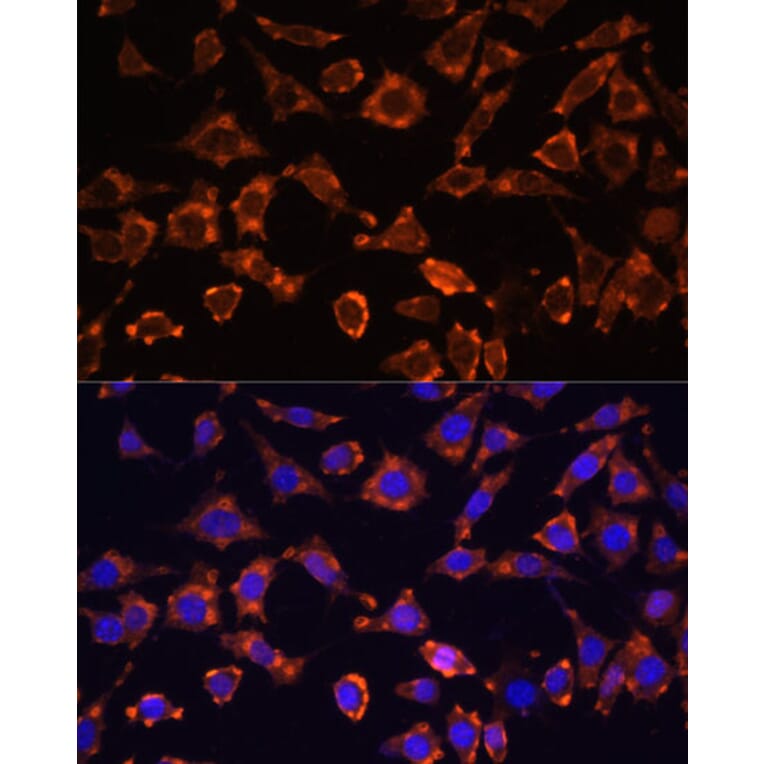Immunofluorescence - Anti-IL-18 Antibody (A88834) - Antibodies.com