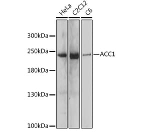 Western Blot - Anti-Acetyl Coenzyme A carboxylase alpha Antibody (A88835) - Antibodies.com