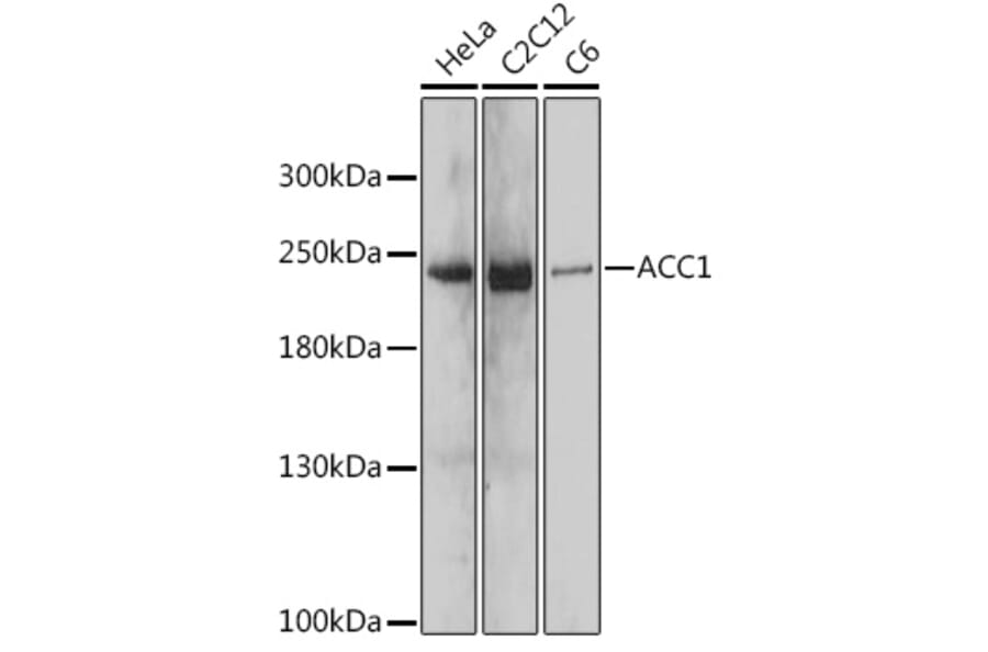 Western Blot - Anti-Acetyl Coenzyme A carboxylase alpha Antibody (A88835) - Antibodies.com