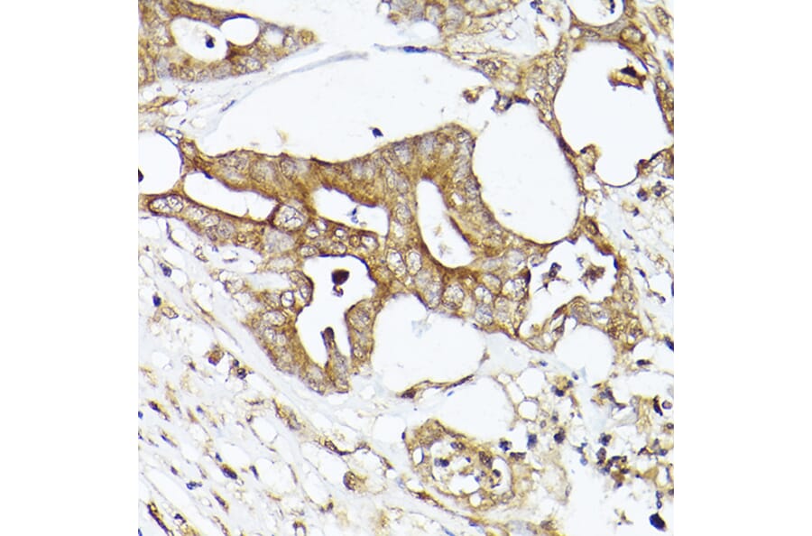 Immunohistochemistry - Anti-Acetyl Coenzyme A carboxylase alpha Antibody (A88835) - Antibodies.com