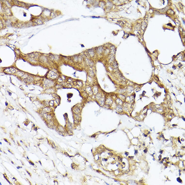 Immunohistochemistry - Anti-Acetyl Coenzyme A carboxylase alpha Antibody (A88835) - Antibodies.com