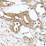 Immunohistochemistry - Anti-Acetyl Coenzyme A carboxylase alpha Antibody (A88835) - Antibodies.com