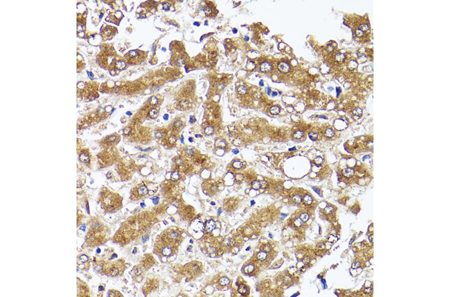 Immunohistochemistry - Anti-Acetyl Coenzyme A carboxylase alpha Antibody (A88835) - Antibodies.com