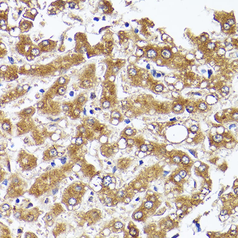 Immunohistochemistry - Anti-Acetyl Coenzyme A carboxylase alpha Antibody (A88835) - Antibodies.com