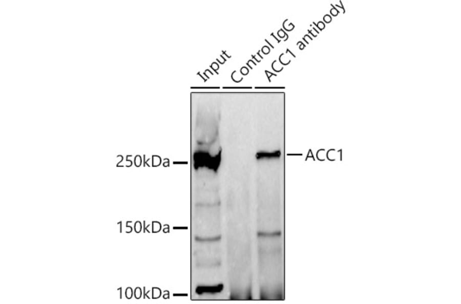Western Blot - Anti-Acetyl Coenzyme A carboxylase alpha Antibody (A88835) - Antibodies.com