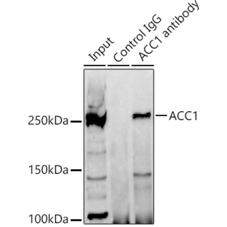 Western Blot - Anti-Acetyl Coenzyme A carboxylase alpha Antibody (A88835) - Antibodies.com