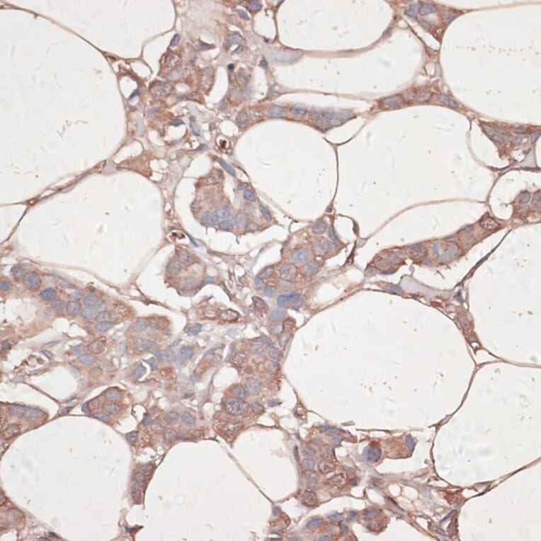 Immunohistochemistry - Anti-Laminin gamma 1 Antibody (A88836) - Antibodies.com