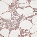 Immunohistochemistry - Anti-Laminin gamma 1 Antibody (A88836) - Antibodies.com