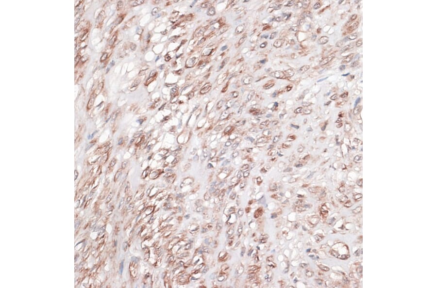 Immunohistochemistry - Anti-Laminin gamma 1 Antibody (A88836) - Antibodies.com