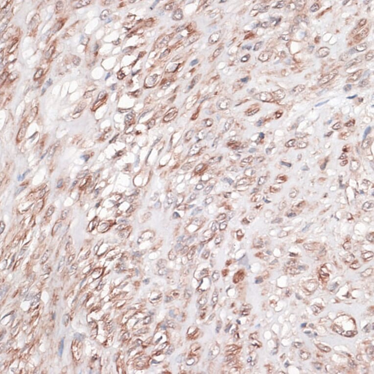 Immunohistochemistry - Anti-Laminin gamma 1 Antibody (A88836) - Antibodies.com