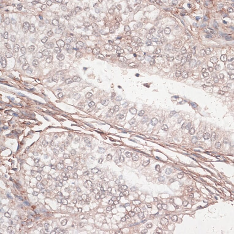 Immunohistochemistry - Anti-Laminin gamma 1 Antibody (A88836) - Antibodies.com