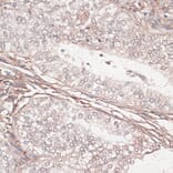 Immunohistochemistry - Anti-Laminin gamma 1 Antibody (A88836) - Antibodies.com