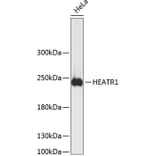 Western Blot - Anti-HEATR1 Antibody (A88837) - Antibodies.com