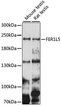 Western blot analysis of extracts of various cell lines, using Anti-FER1L5 Antibody (A15926) at 1000 dilution.
Secondary antibody: Goat Anti-Rabbit IgG (H+L) (HRP) (AS014) at 1:10,000 dilution.
Lysates / proteins: 25µg per lane.
Blocking buffer: 3% non-fat dry milk in TBST.
Detection: ECL Basic Kit (RM00020).
Exposure time: 150s.