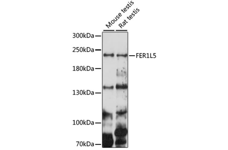 Western Blot - Anti-FER1L5 Antibody (A88838) - Antibodies.com
