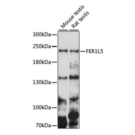 Western Blot - Anti-FER1L5 Antibody (A88838) - Antibodies.com