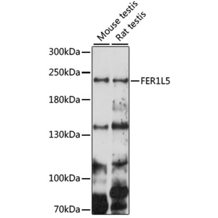 Western Blot - Anti-FER1L5 Antibody (A88838) - Antibodies.com