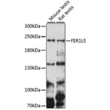 Western Blot - Anti-FER1L5 Antibody (A88838) - Antibodies.com
