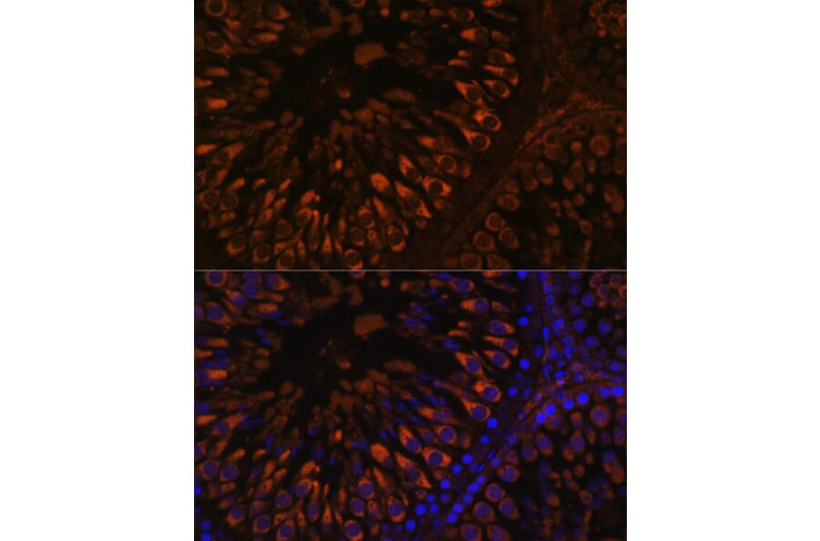 Immunofluorescence - Anti-FER1L5 Antibody (A88838) - Antibodies.com
