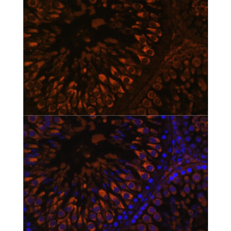 Immunofluorescence - Anti-FER1L5 Antibody (A88838) - Antibodies.com