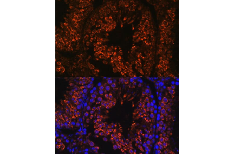 Immunofluorescence - Anti-FER1L5 Antibody (A88838) - Antibodies.com